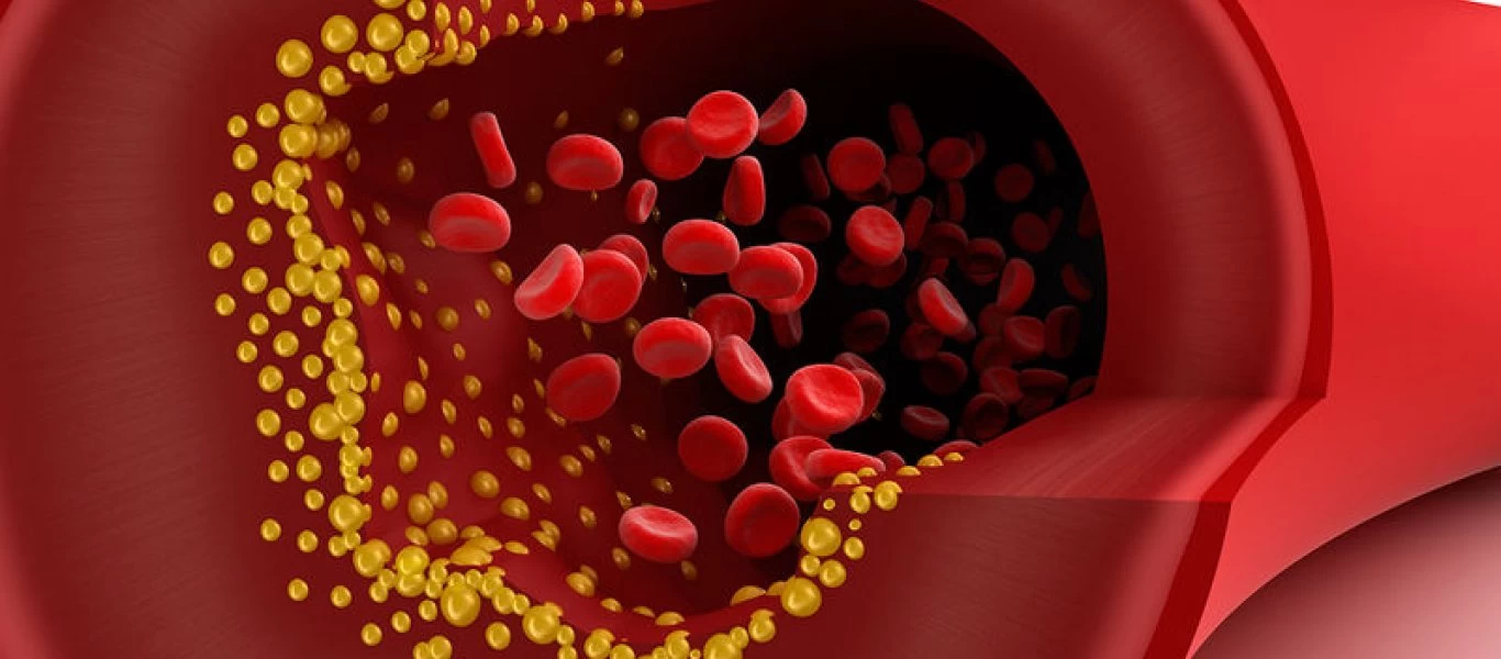 Χοληστερόλη: Τι πρέπει να προσέχω και πως να τρέφομαι